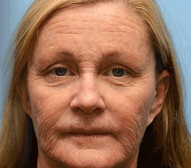 𝐀𝐏𝐊𝐀𝐏𝐊™ 𝐌É𝐇𝐌É𝐑𝐄𝐆 Á𝐓𝐅𝐎𝐆Ó 𝐊𝐑É𝐌🥇🥇𝐀 𝐛ö𝐫𝐩𝐫𝐨𝐛𝐥é𝐦á𝐤 𝐤𝐞𝐳𝐞𝐥é𝐬𝐞 𝐦𝐚𝐠á𝐛𝐚𝐧 𝐟𝐨𝐠𝐥𝐚𝐥𝐣𝐚: é𝐥𝐞𝐭𝐤𝐨𝐫𝐢 𝐟𝐨𝐥𝐭𝐨𝐤, 𝐡𝐞𝐠𝐞𝐤, 𝐬𝐳𝐞𝐦ö𝐥𝐜𝐬ö𝐤, 𝐛ö𝐫𝐧ö𝐯𝐞𝐝é𝐤𝐞𝐤, 𝐭á𝐥𝐲𝐨𝐠𝐨𝐤, 𝐩𝐚𝐭𝐭𝐚𝐧á𝐬𝐨𝐤, 𝐞𝐤𝐜é𝐦𝐚, 𝐩𝐬𝐨𝐫𝐢𝐚𝐬𝐢𝐬, 𝐚𝐜𝐧𝐞 𝐢𝐧𝐯𝐞𝐫𝐬𝐚, 𝐫á𝐧𝐜𝐨𝐤, 𝐛ö𝐫ö𝐫𝐞𝐠𝐞𝐝é𝐬 é𝐬 𝐞𝐠𝐲é𝐛 𝐩𝐫𝐨𝐛𝐥é𝐦á𝐤🔥🔥