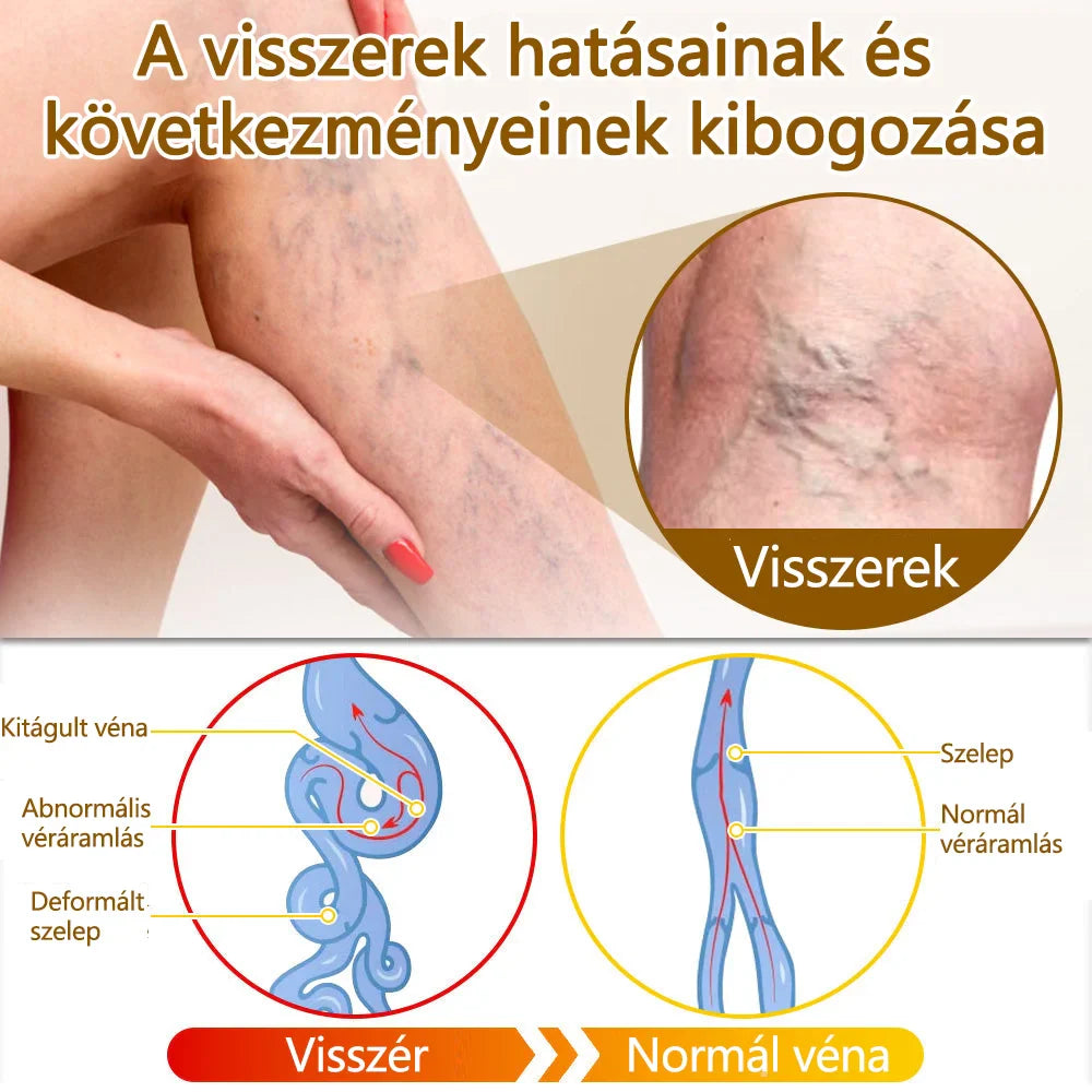 ✅flysmus™ méhméreg kezelő krém🐝: Ekcéma, pikkelysömör, akne, rosacea, gombás fertőzések, szemölcsök kezelése🐝🐝
