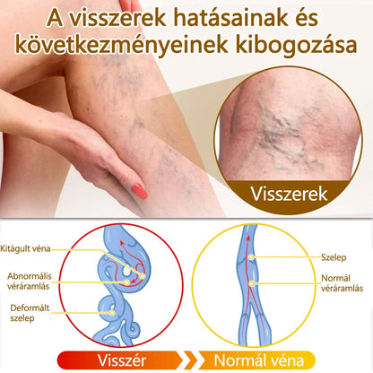✅flysmus™ méhméreg kezelő krém🐝: Ekcéma, pikkelysömör, akne, rosacea, gombás fertőzések, szemölcsök kezelése🐝🐝